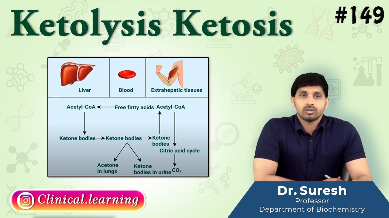 149. Ketolysis Ketosis