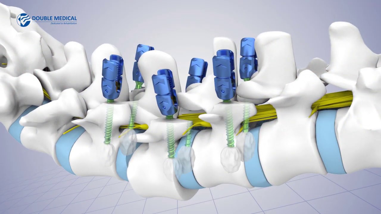 Double Medical TINA System