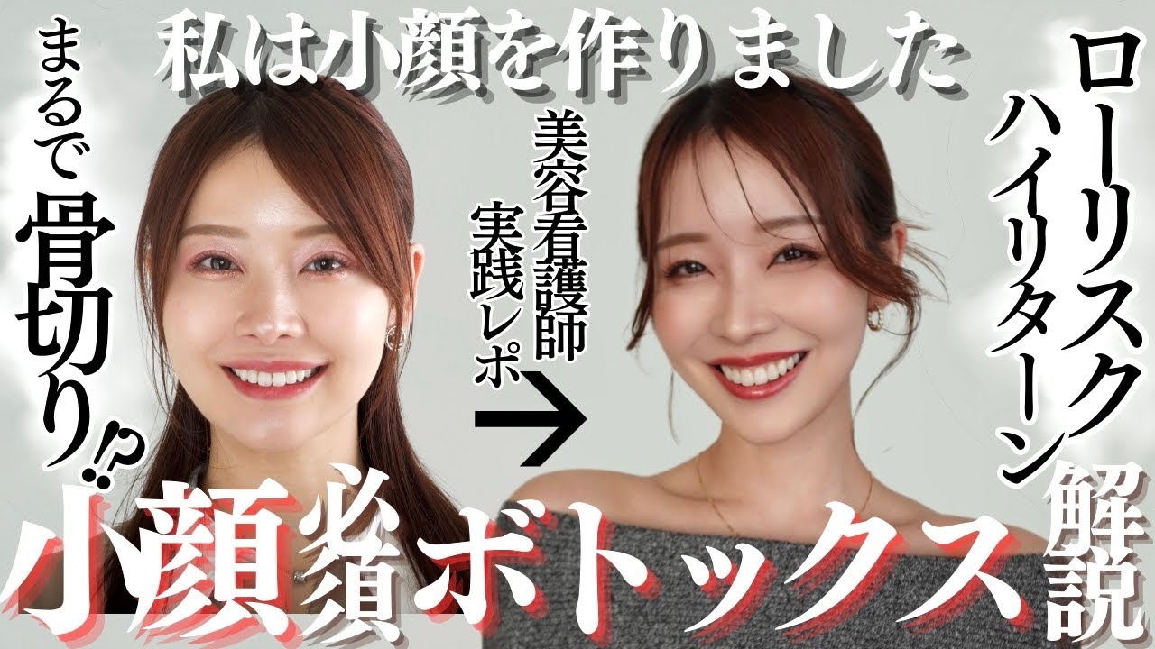 【リアル小顔治療】美容看護師が実践している切らない小顔整形。頬コケ・たるみを防ぐボトックスの打ち方を医師が解説｜カウンセリング〜DT経過まで公開