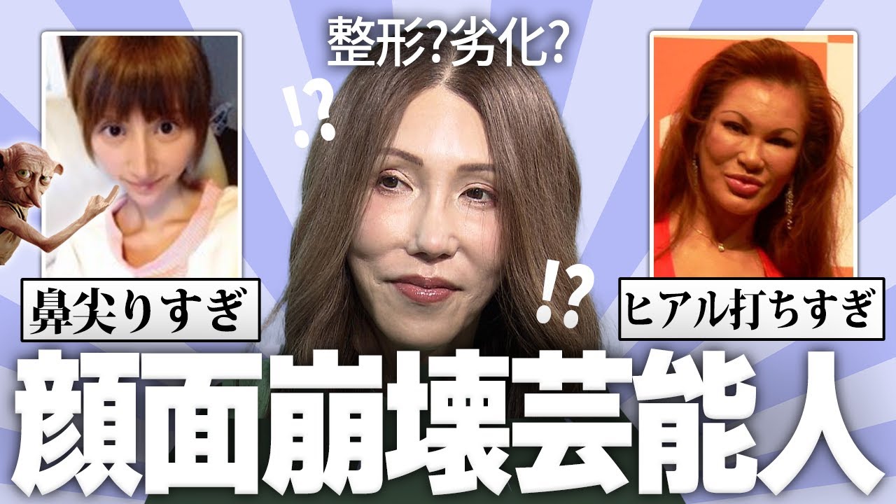 【有益】衝撃的な顔面になった芸能人の画像w