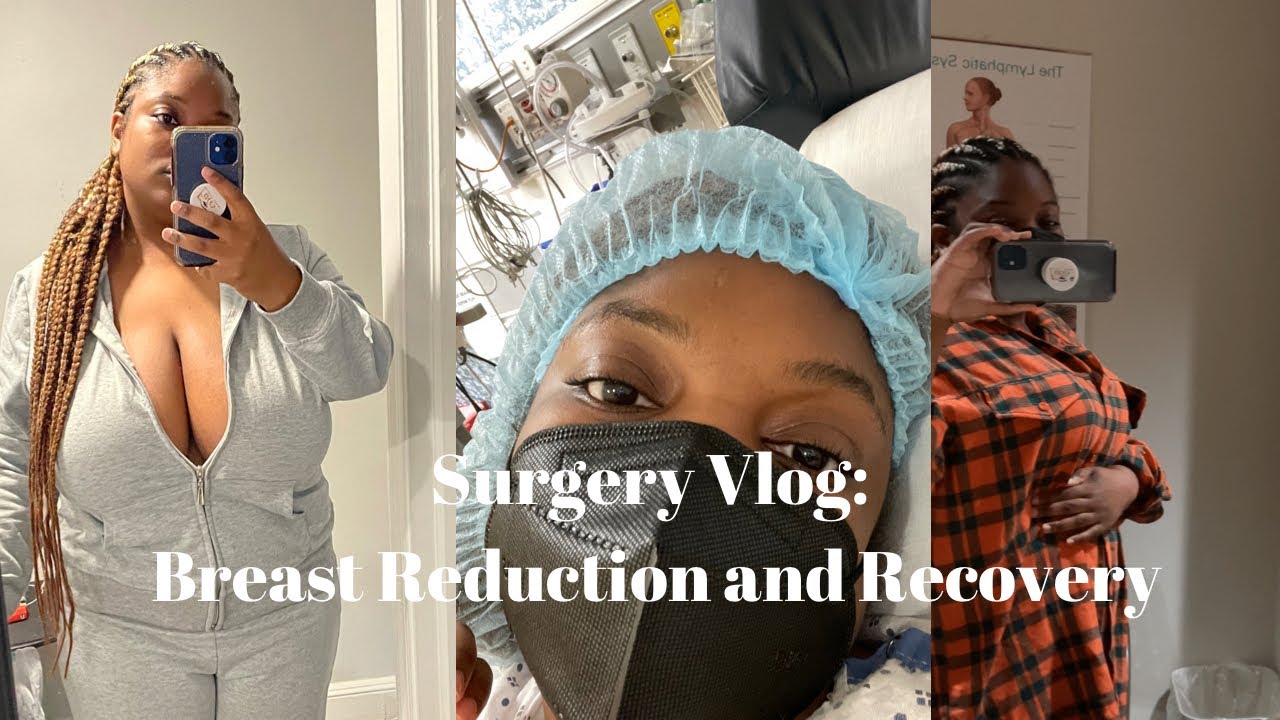 I GOT A BOOB JOB | BILATERAL BREAST REDUCTION | SURGERY VLOG | 7 POUNDS OF BREAST TISSUE  REMOVED