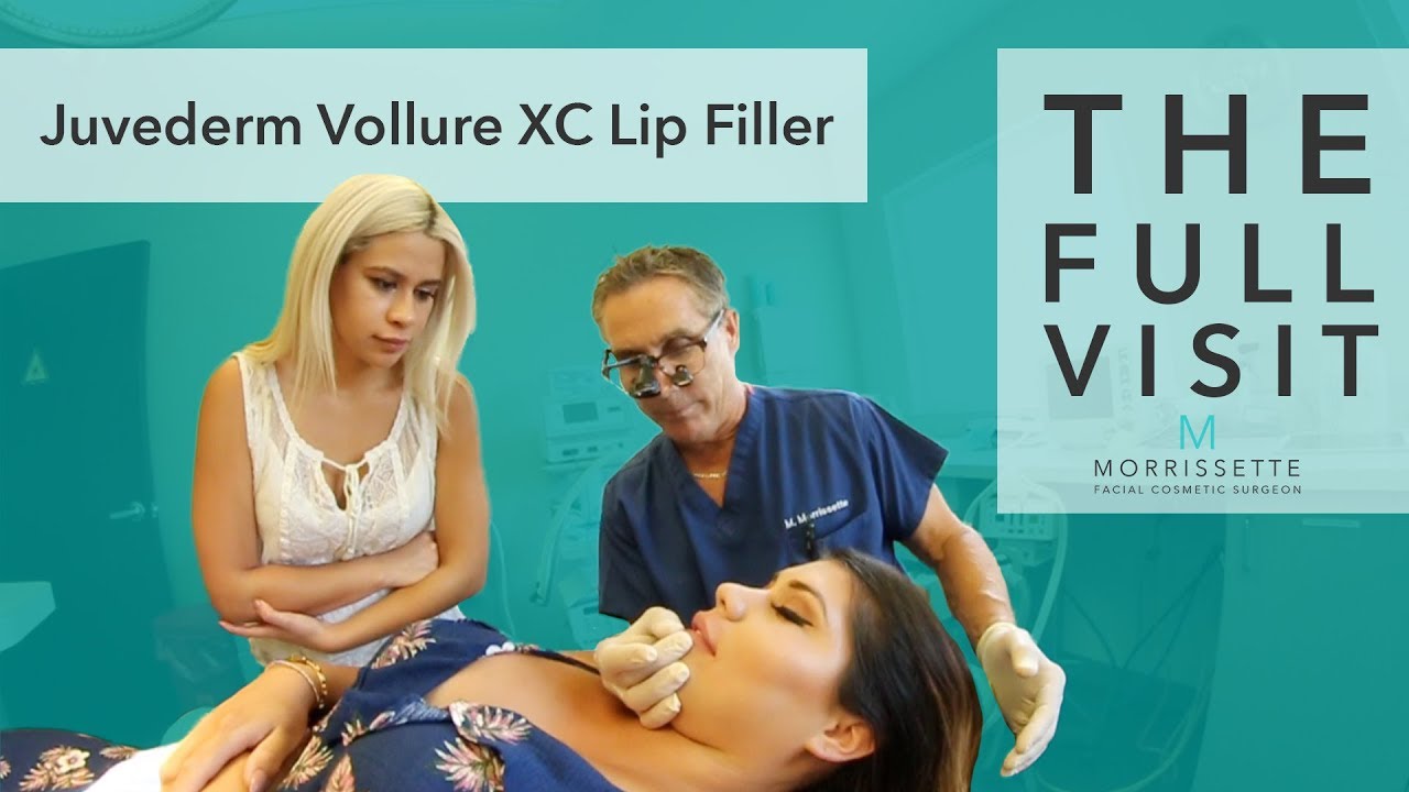 The Full Visit:  Lip Filler Juvederm Vollure XC by Dr. Michael Morrissette in Ventura
