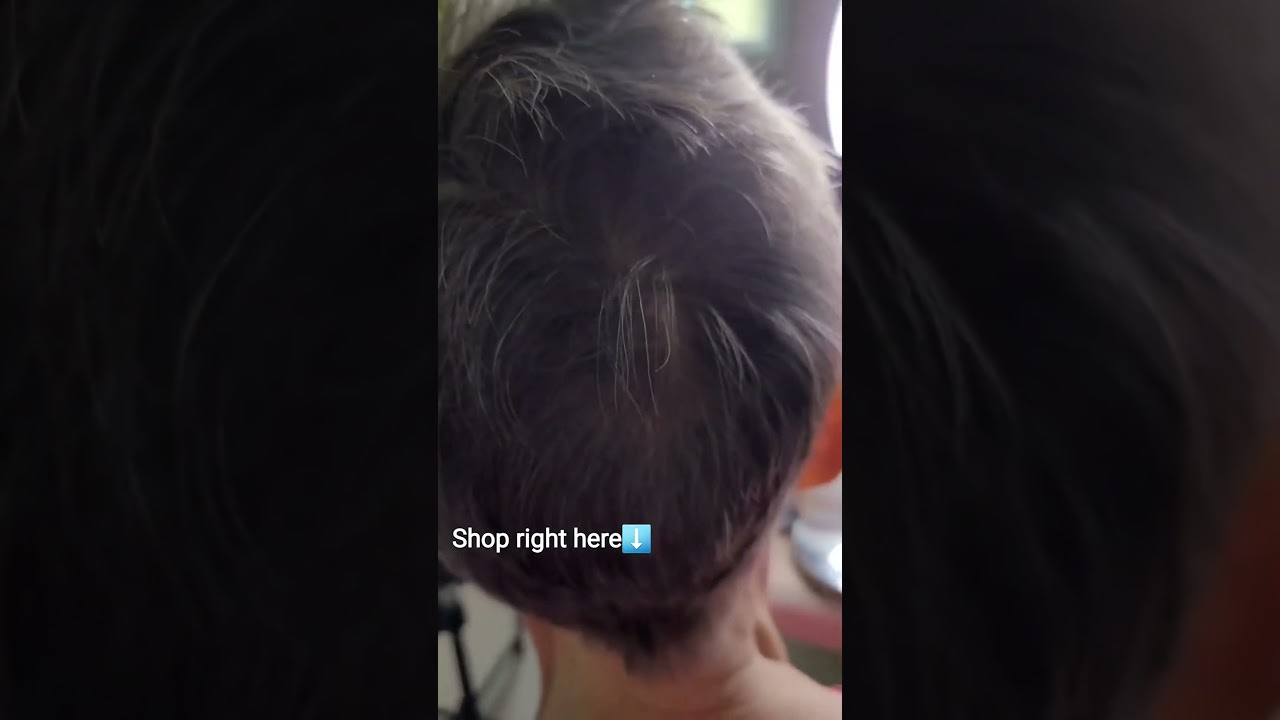 Covering Bald Spots in Seconds (Yes, Really)❤️