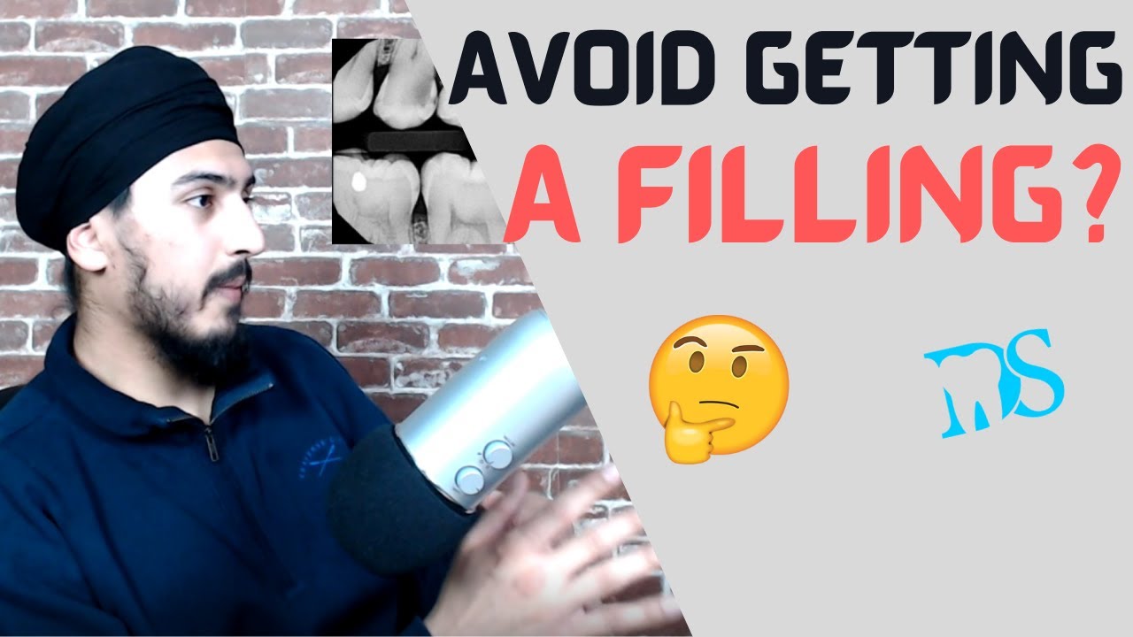 Is Your Dentist Lying? - What If You DON'T Get That Filling?