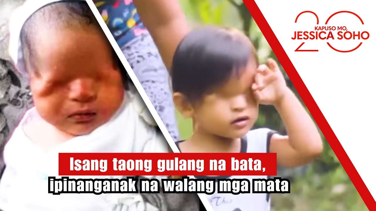 Isang taong gulang na bata, ipinanganak na walang mga mata | Kapuso Mo, Jessica Soho