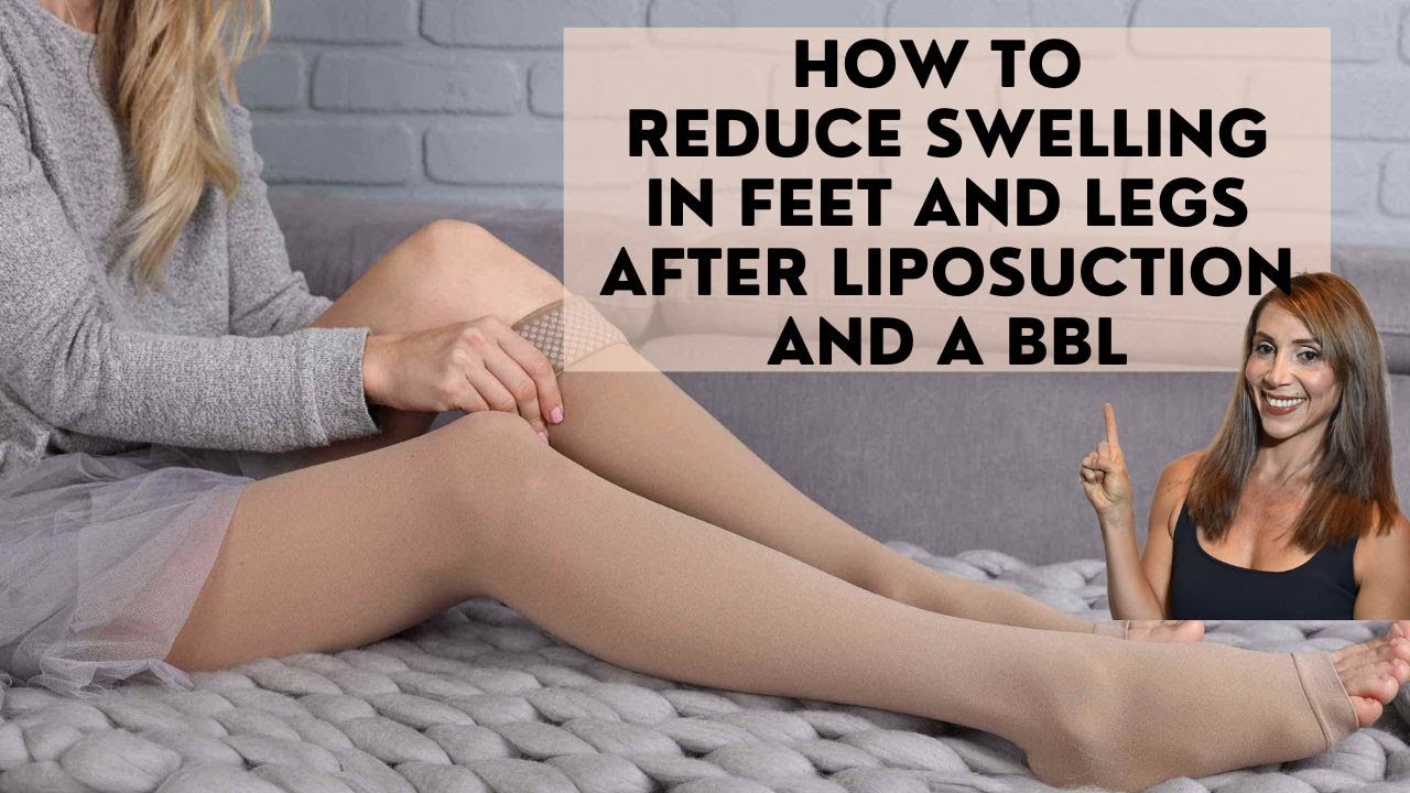 How to reduce swelling in feet and legs after liposuction and a Brazilian Buttocks Lift?