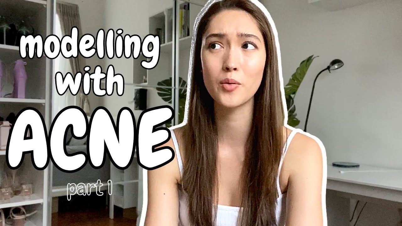 My Acne Struggles!!! | Modelling with Acne - PART 1 | Aimee Cheng-Bradshaw