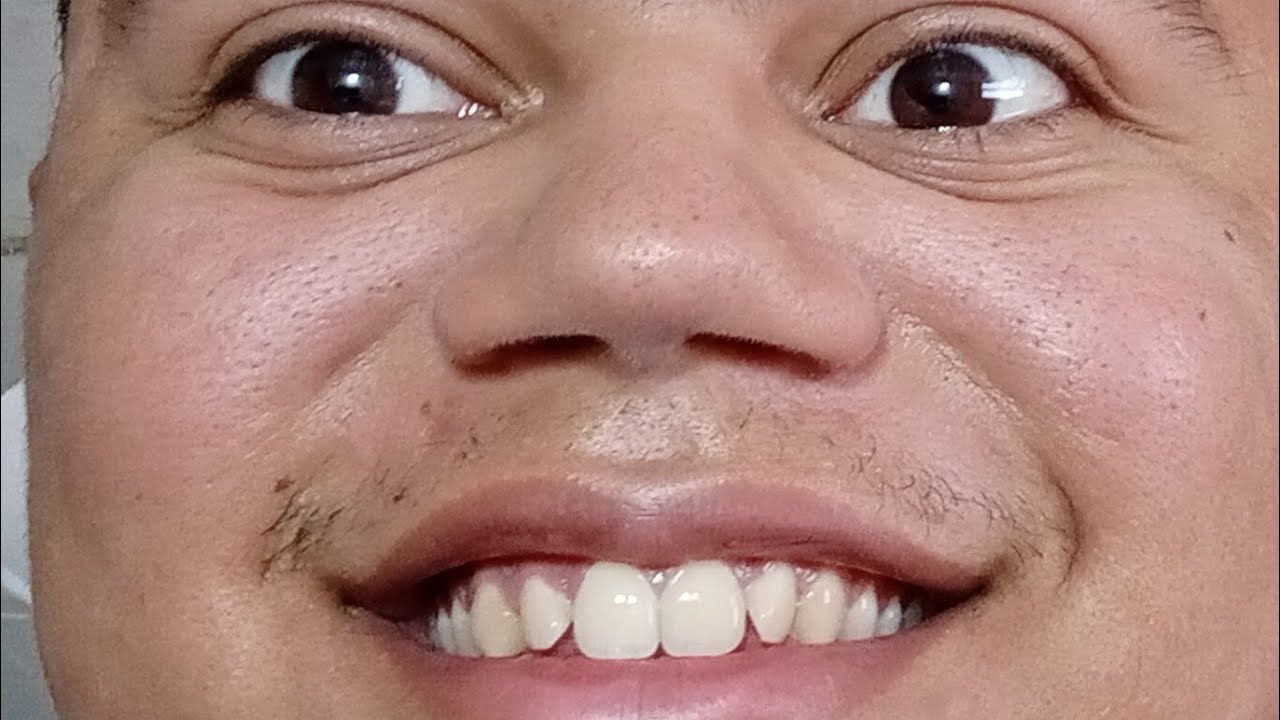 Live do milagre - saindo da solidão - perseverança para vencer na vida