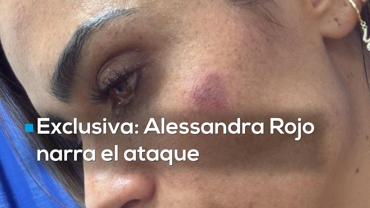 #Exclusiva | Agreden a la alcaldesa Alessandra Rojo en operativo; entrevista con Javier Alatorre