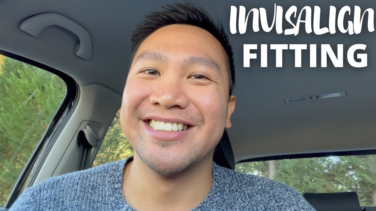 FIRST OFFICIAL INVISALIGN APPOINTMENT | Attachment Fitting & Enamel Filing | Invisalign Journal