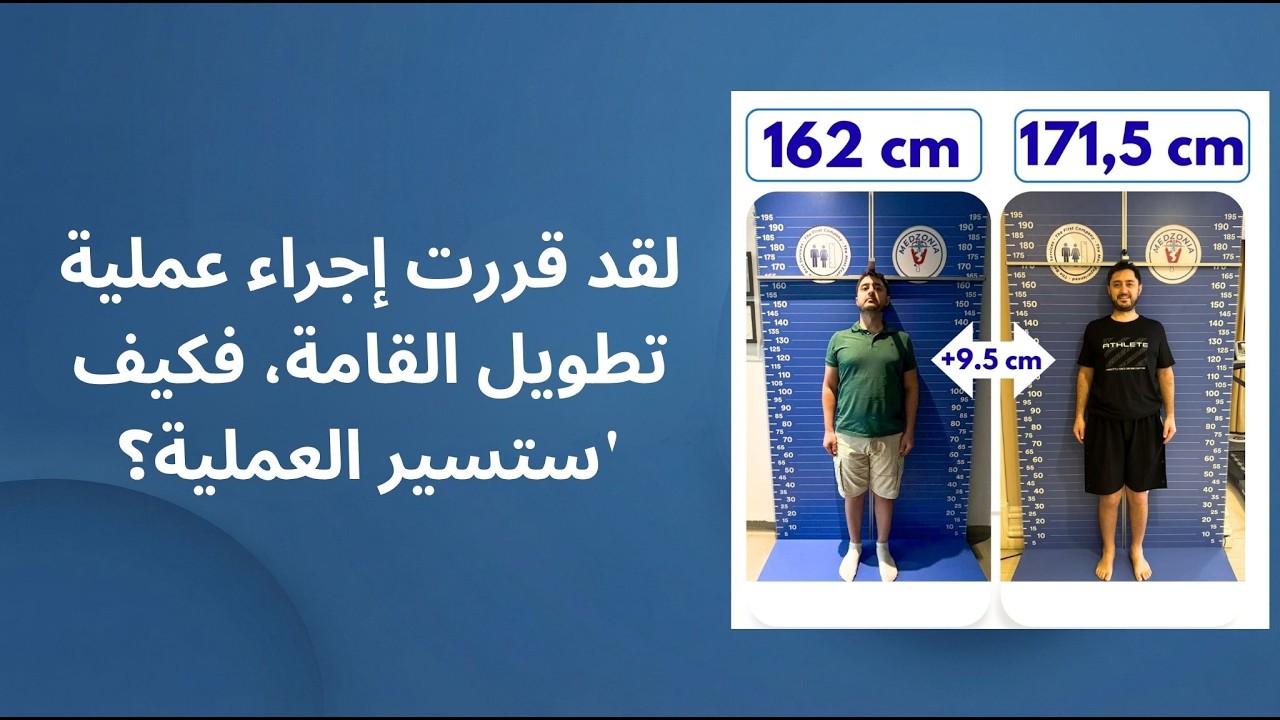كيف زاد طوله 9.5 سم؟ رحلة مريضنا الذي خضع لعملية إطالة القامة
