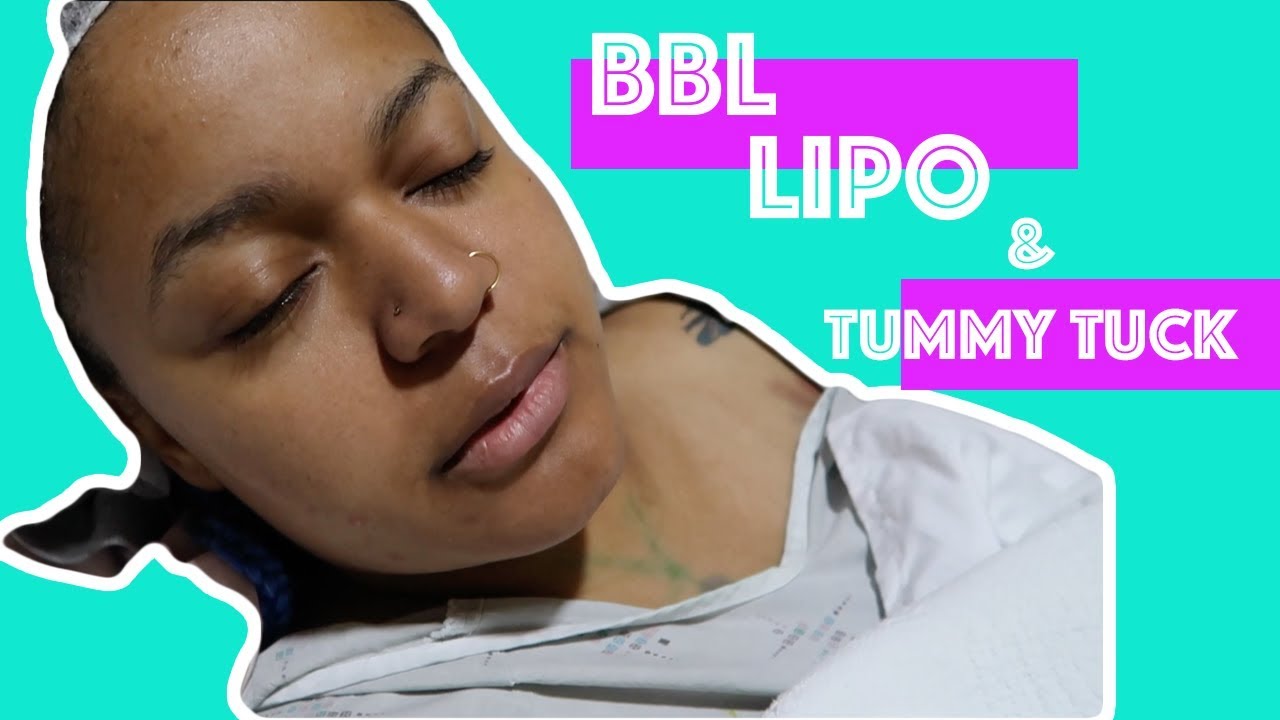 DON’T get a BBL in Dominican Republic until you WATCH this!!