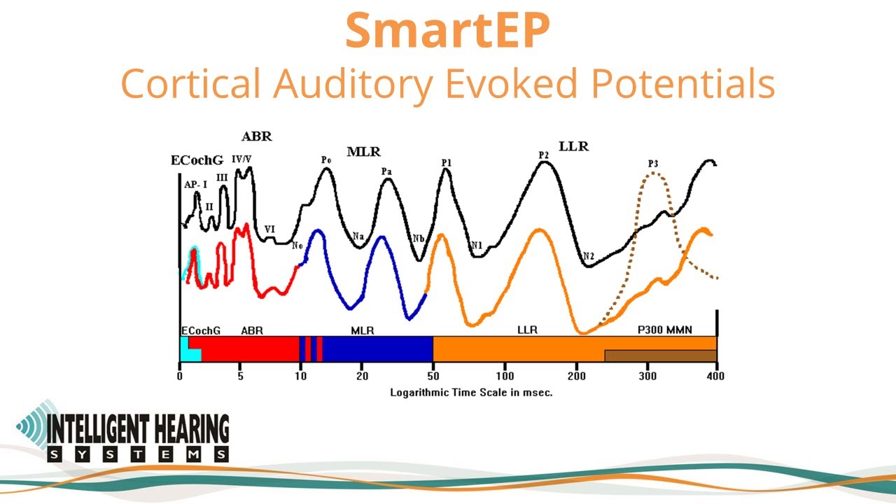 SmartEP: Overview of Cortical Auditory Evoked Potential options