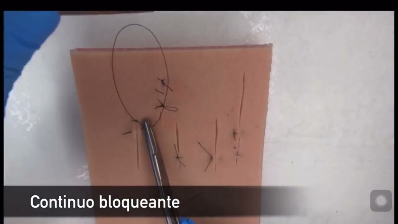 Continuo bloqueante