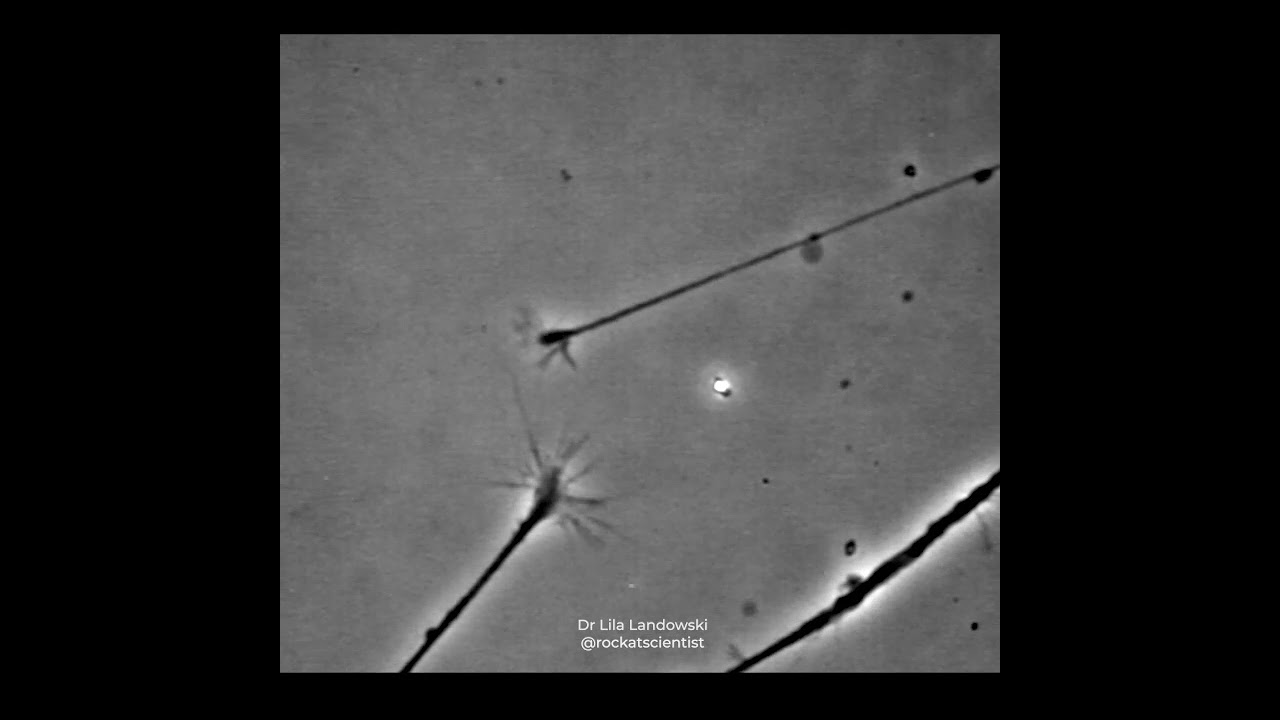 FINDING THAT CONNECTION &copy; - Neurons connecting in a petri dish - growth cones sensing one another