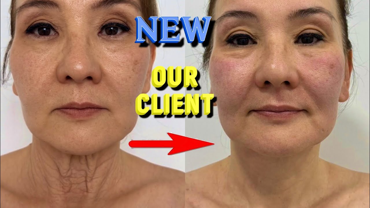 How to GET RID OF SAGGING Neck | WRINKLES on the Neck | THE BEST FROM MASSAGE 🔥| Do it with me