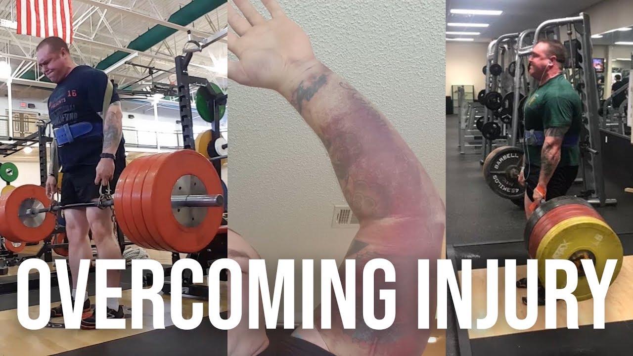 Deadlifting 815 lbs After a Bicep Tear