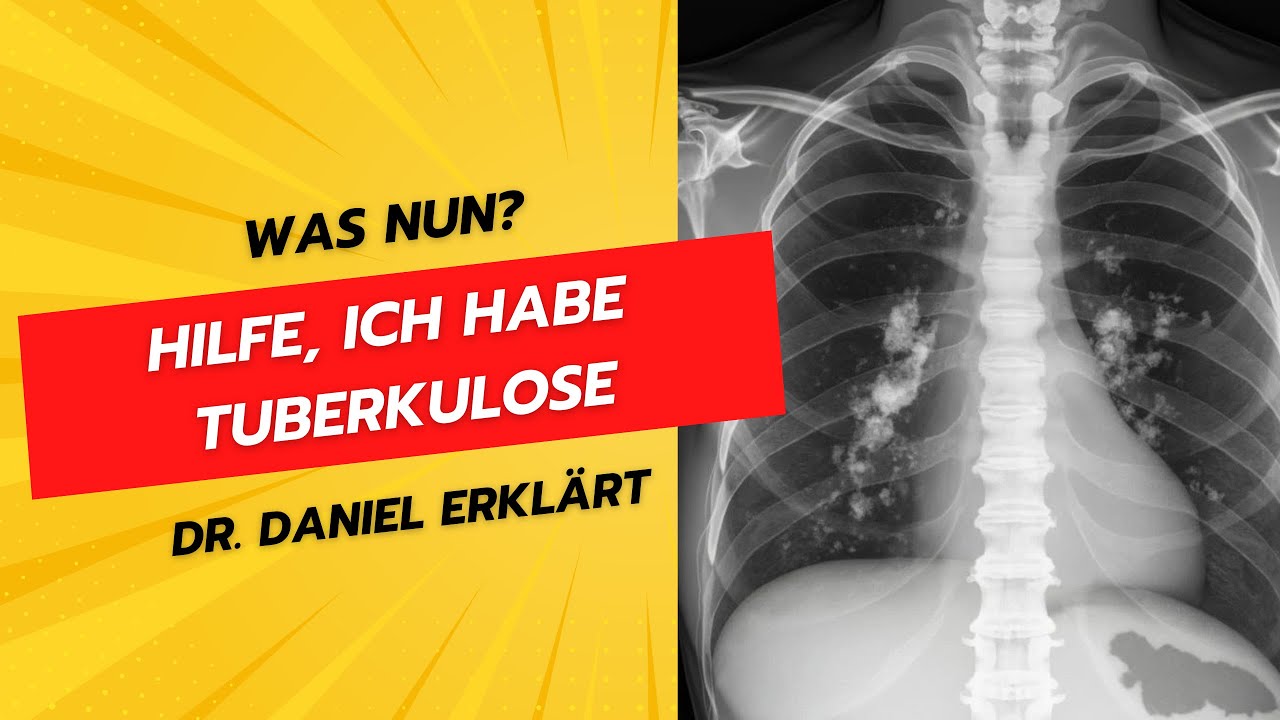 Tuberkulose erklärt vom Arzt: Symptome, Ansteckung, Test & Behandlung einfach erklärt - Dr. Daniel