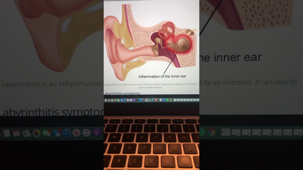 Stapedectomy