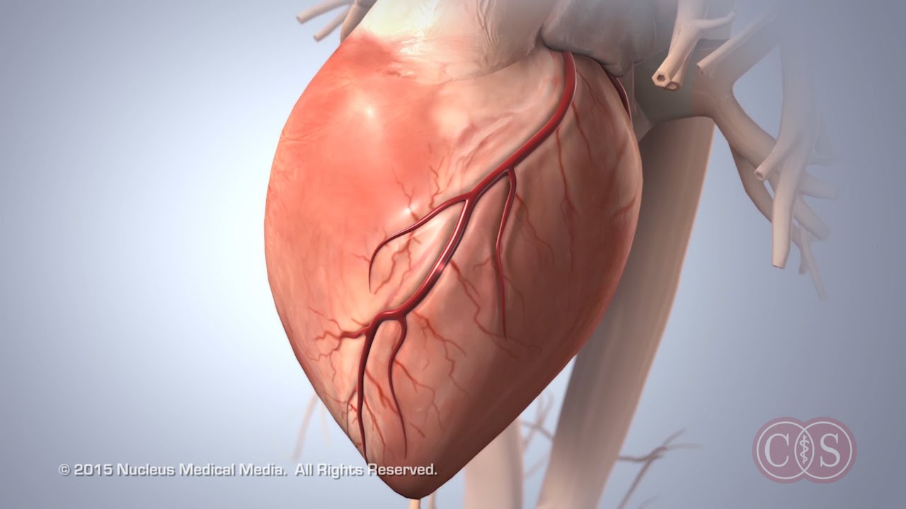 Symptoms of Sudden Cardiac Arrest | Cedars-Sinai