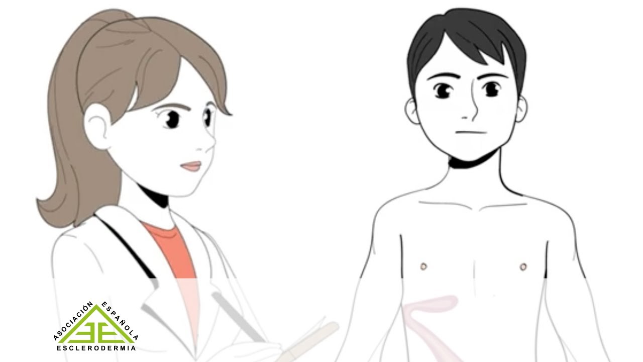 Esclerodermia localizada o Morfea