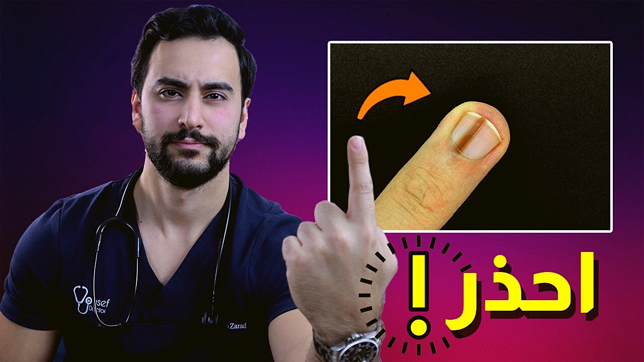 الرد على التعليقات #1| هل الخط الأسود في الظفر خطير؟