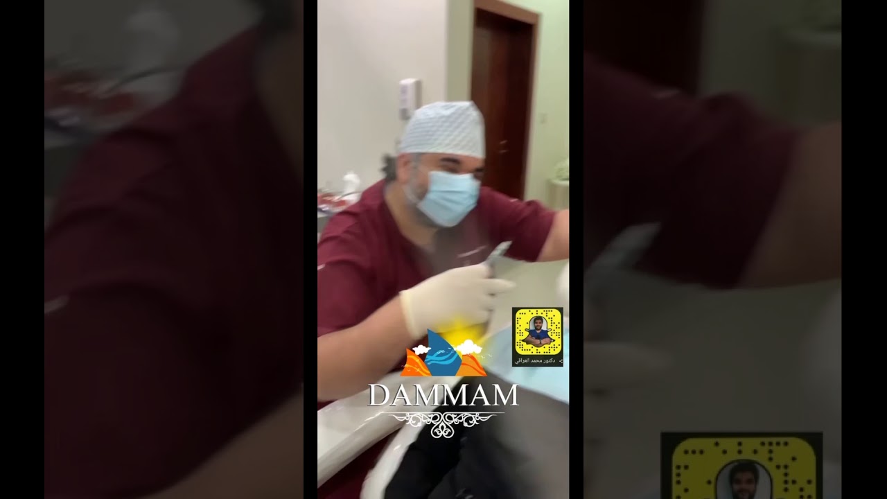 كونتور و زم الشفايف بالفيلر و الخيوط
