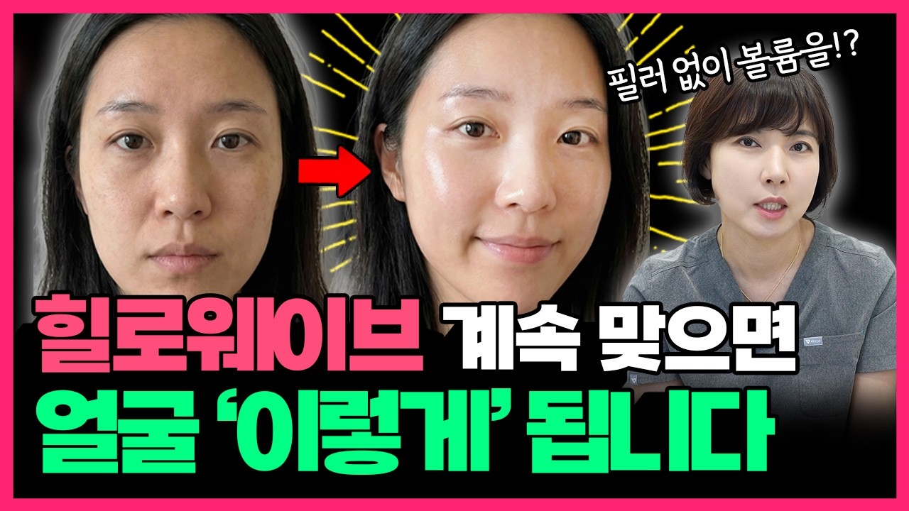 힐로웨이브, 효과 모르겠다고요? 힐로웨이브 진짜 효과 보는 팁부터 원리, 부작용까지 이 한 편으로 총정리해드립니다!