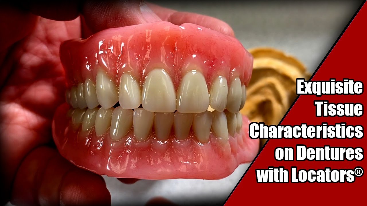 Making Exquisite Tissue Line Characteristics on Dentures with Locators®