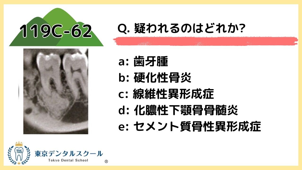 骨病変の鑑別＋画像×選択肢の消去法テクニック完全公開 119C-62