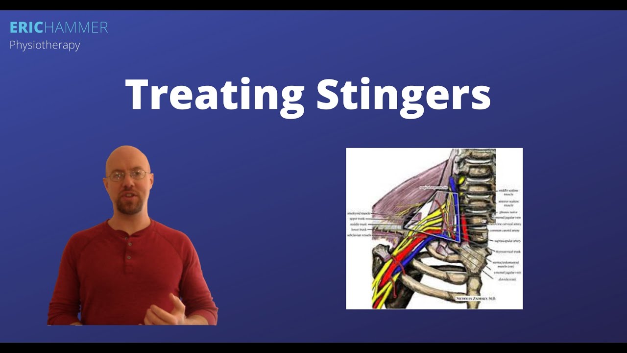 Treating Stingers