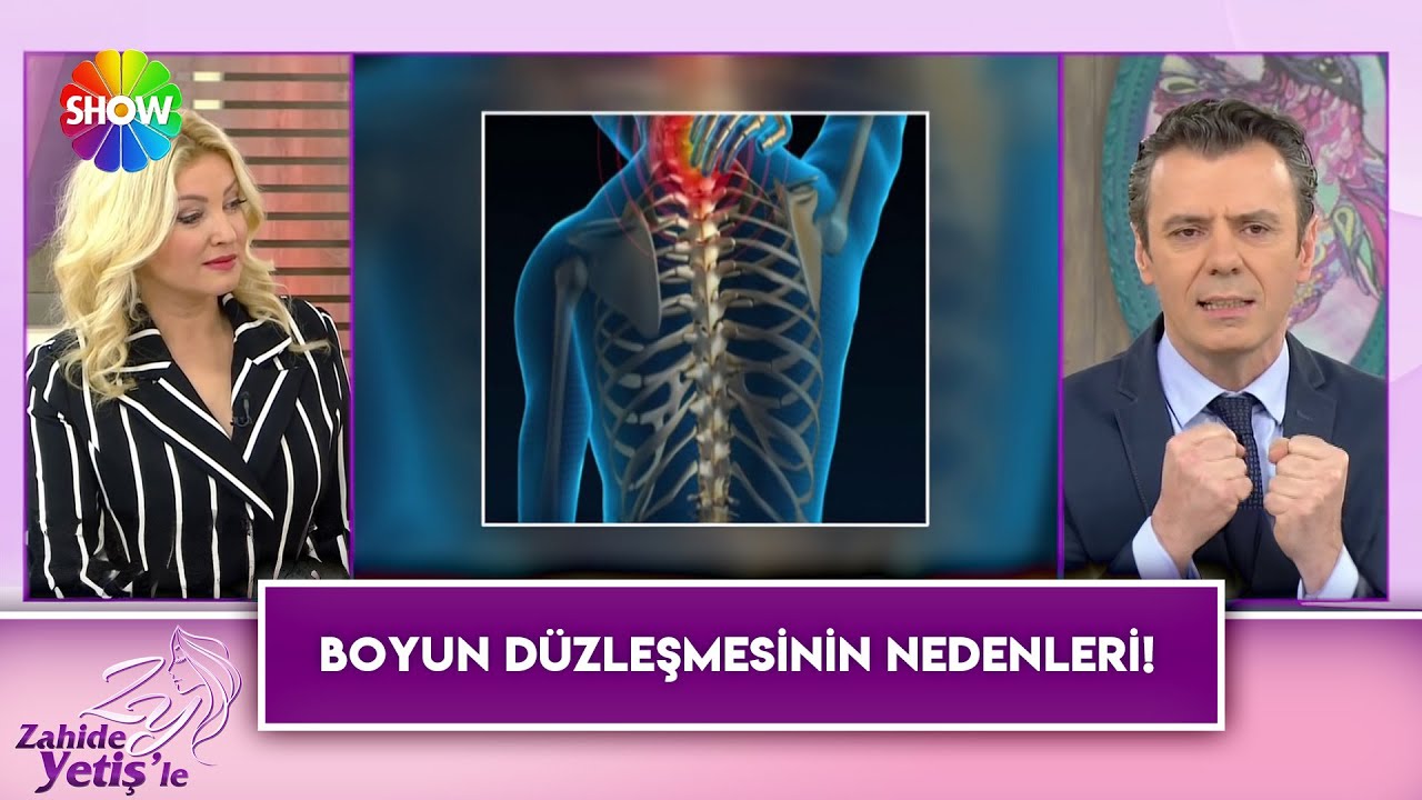 Boyun düzleşmesi nedir? Boyun düzleşmesi neden olur?