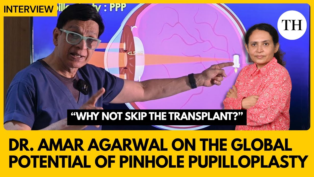 “Why not skip the transplant?”: Dr. Amar Agarwal on the global potential of Pinhole Pupilloplasty