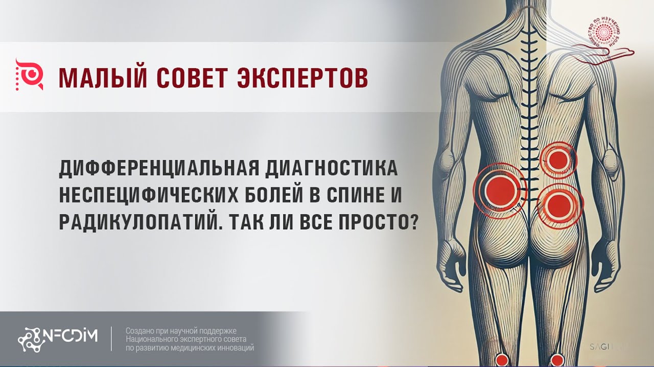 Дифференциальная диагностика неспецифических болей в спине и радикулопатий. Так ли все просто?
