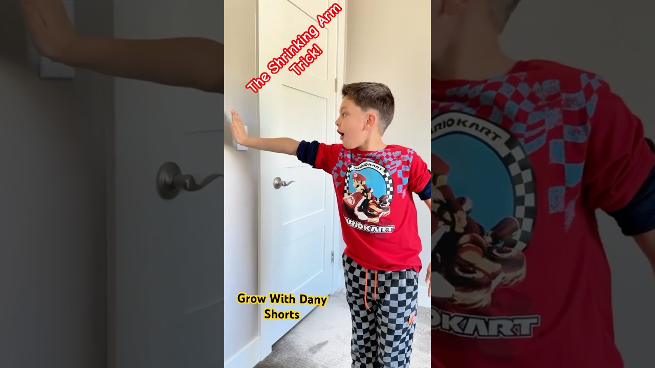 Crazy Short Arm Trick 💪 🪄