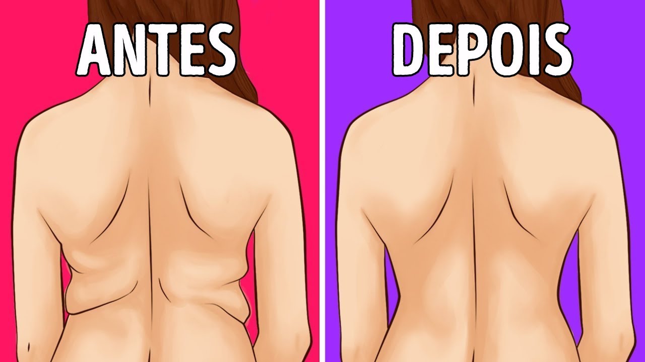 8 Maneiras Super Fáceis De Reduzir os Pneuzinhos Laterais Rapidamente