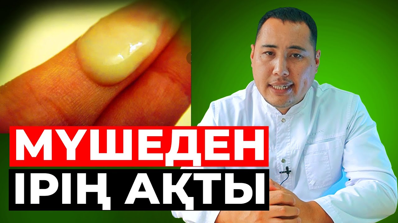 Мүшеден ірің ағуы! Ифекцияны қалай емдейміз?