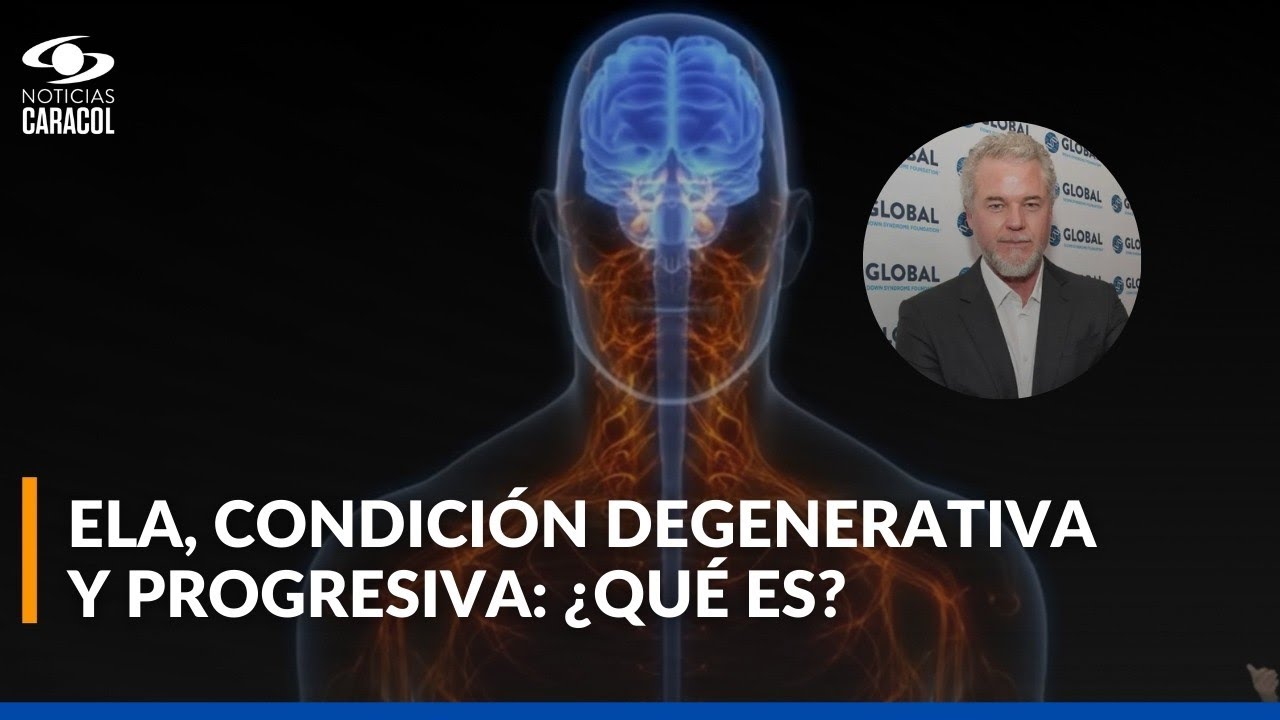 ¿Qué es la Esclerosis lateral amiotrófica, la enfermedad que le causó la muerte al actor Eric Dane?