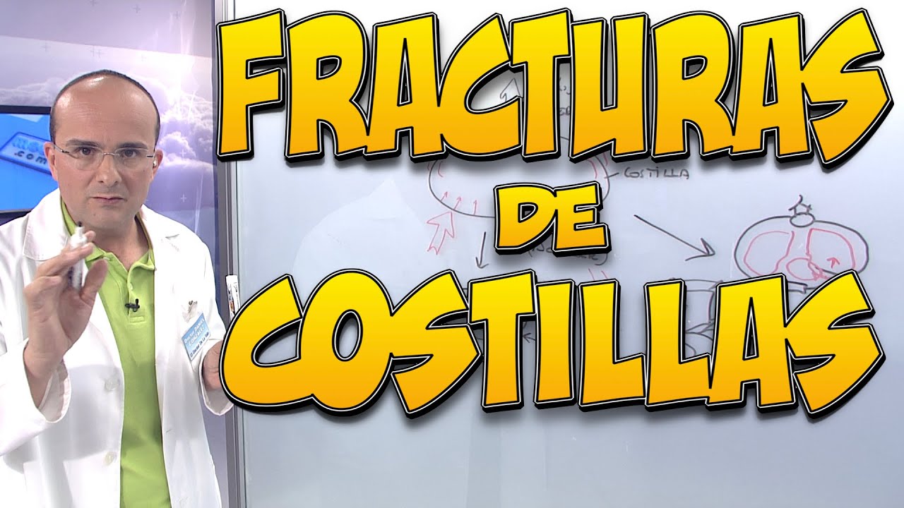 FRACTURAS DE COSTILLAS - Todo lo que necesita saber
