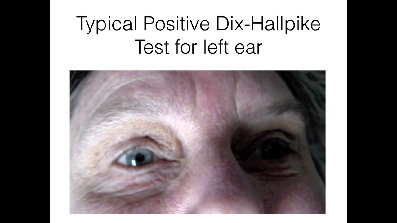 A Basic, Simplified Approach to the Dizzy Patient Part 1