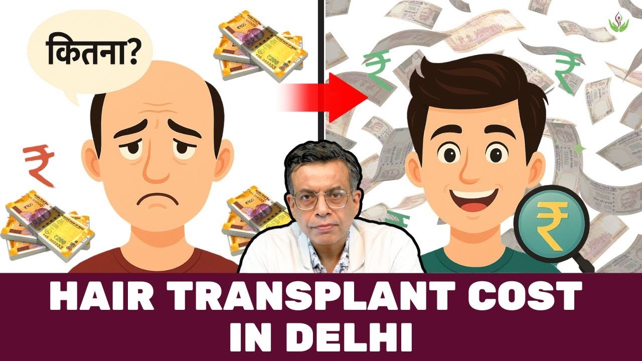 Hair Transplant Cost in Delhi 💰 | Real Price & Hidden Truth Revealed by Dr. Sandeep Bhasin