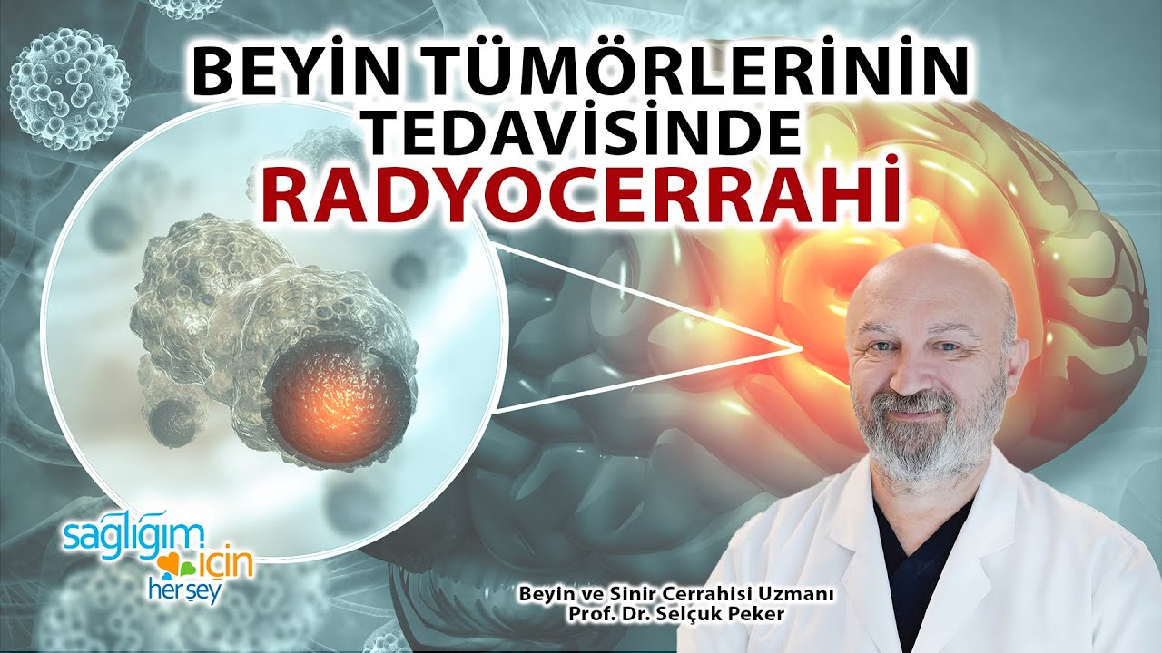 Beyin Tümörlerinin Tedavisinde Radyocerrahi