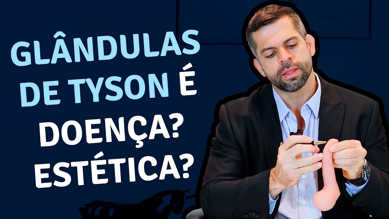 Glândulas de Tyson é doença  Estética? | Dr. Marco Túlio  - Urologista e Andrologista