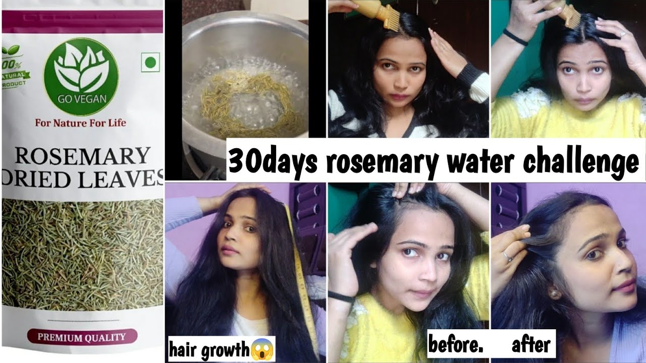 rosemary water 30 day hair regrowth, challenge with shocking results 😱😱 before & after result