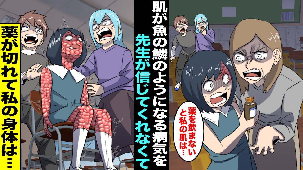 【漫画】肌が魚の鱗のようになる病気になってしまった私は薬で進行を遅らせていたが新任の先生は私の病気を信じてくれず…薬が切れて私の身体はおかしくなってしまい・・・