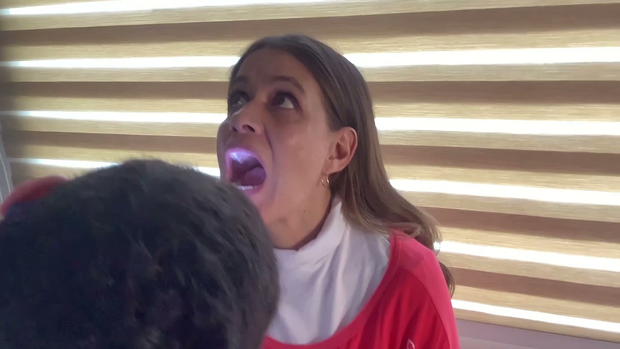 EXPLORACIÓN FÍSICA DE LA CAVIDAD ORAL