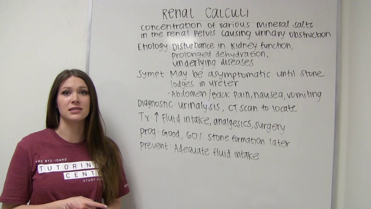 Renal Calculi