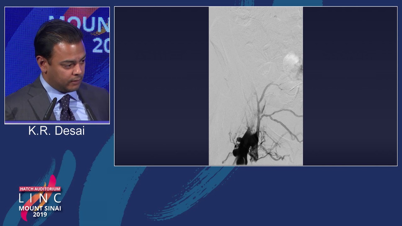 Hatch D1 - How I Do It: Deep Vein Thrombectomy - Dr. Kush Desai