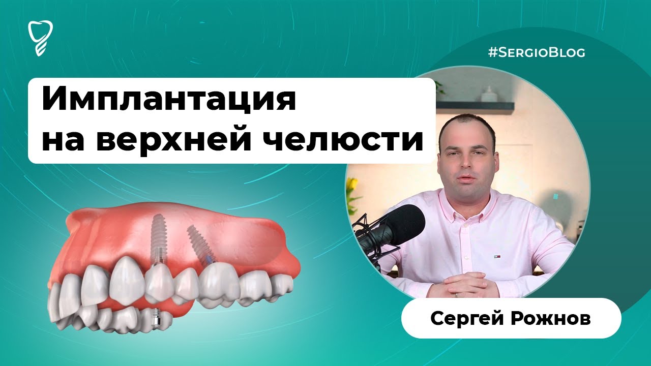 Синус-лифтинг и гайморит: как это происходит? #SergioBlog