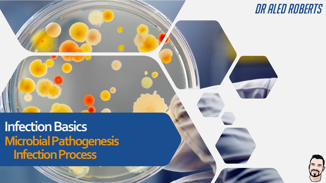 Microbial Pathogenesis, Infection Process